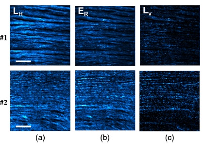 Polarization dependence of aligned collagen tissues imaged with second harmonic generation microscopy | Laboratorio de Óptica. Universidad Murcia
